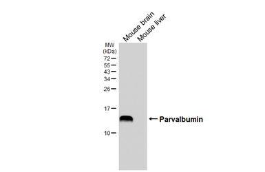 Anti-Parvalbumin antibody [HL6691] used in Western Blot (WB). GTX649402