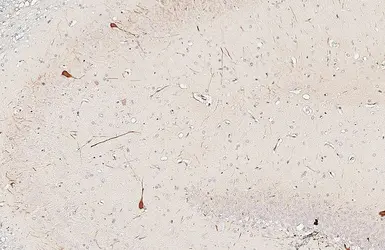 Anti-Parvalbumin antibody [HL6691] used in IHC (Paraffin sections) (IHC-P). GTX649402