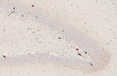 Anti-Parvalbumin antibody [HL6691] used in IHC (Paraffin sections) (IHC-P). GTX649402