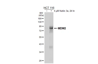 Anti-MDM2 antibody [HL6717] used in Western Blot (WB). GTX649428