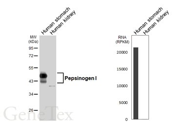 Anti-PGA3 antibody [HL6721] used in Western Blot (WB). GTX649432