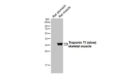 Anti-Troponin T1 (slow) skeletal muscle antibody [HL6725] used in Western Blot (WB). GTX649448