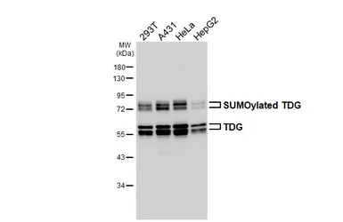 Anti-TDG antibody [HL6733] used in Western Blot (WB). GTX649456