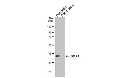 Anti-SOX1 antibody [HL6737] used in Western Blot (WB). GTX649460