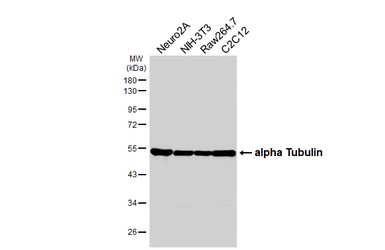 Anti-alpha Tubulin 4a antibody [HL6756] used in Western Blot (WB). GTX649479