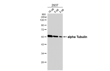 Anti-alpha Tubulin 4a antibody [HL6756] used in Western Blot (WB). GTX649479