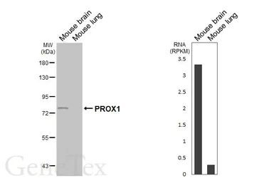 Anti-PROX1 antibody [HL6773] used in Western Blot (WB). GTX649504