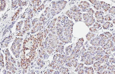 Anti-MAN2A1 antibody [HL6777] used in IHC (Paraffin sections) (IHC-P). GTX649508
