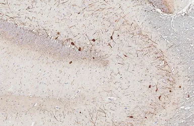 Anti-Parvalbumin antibody [HL6815] used in IHC (Paraffin sections) (IHC-P). GTX649629