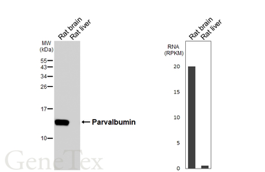 Anti-Parvalbumin antibody [HL6816] used in Western Blot (WB). GTX649630