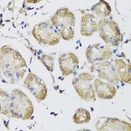 Anti-USH1C antibody used in IHC (Paraffin sections) (IHC-P). GTX64965
