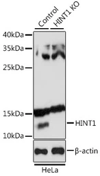 Anti-HINT1 antibody used in Western Blot (WB). GTX64971
