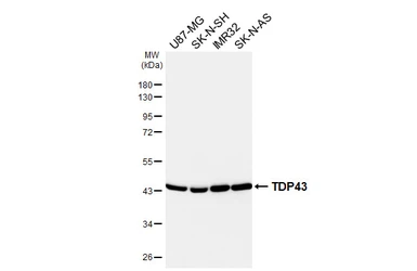 Anti-TDP43 antibody [GT733-CHK] used in Western Blot (WB). GTX649777