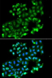 Anti-PHF11 antibody used in Immunocytochemistry/ Immunofluorescence (ICC/IF). GTX65536