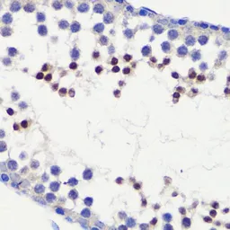Anti-HFM1 antibody used in IHC (Paraffin sections) (IHC-P). GTX65542