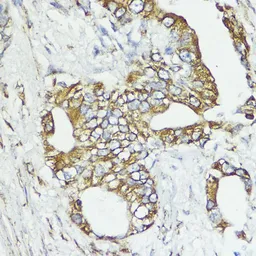 Anti-SOCS6 antibody used in IHC (Paraffin sections) (IHC-P). GTX65551