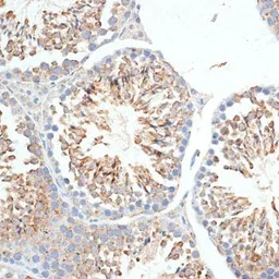 Anti-KLHL9 antibody used in IHC (Paraffin sections) (IHC-P). GTX65557