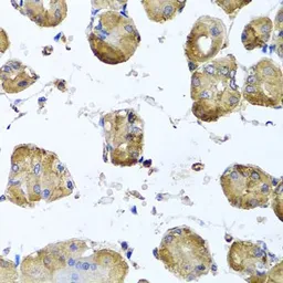 Anti-beta Tubulin 8 antibody used in IHC (Paraffin sections) (IHC-P). GTX65574