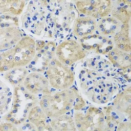 Anti-beta Tubulin 8 antibody used in IHC (Paraffin sections) (IHC-P). GTX65574