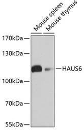 Anti-HAUS6 antibody used in Western Blot (WB). GTX65582