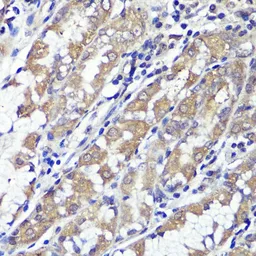 Anti-UBL3 antibody used in IHC (Paraffin sections) (IHC-P). GTX65591