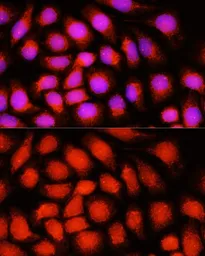 Anti-DNAJB14 antibody used in Immunocytochemistry/ Immunofluorescence (ICC/IF). GTX65594