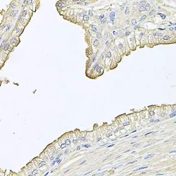 Anti-FABP12 antibody used in IHC (Paraffin sections) (IHC-P). GTX65608