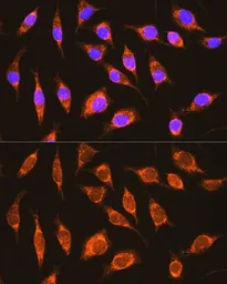 Anti-NDUFA8 antibody used in Immunocytochemistry/ Immunofluorescence (ICC/IF). GTX65622