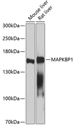 Anti-MAPKBP1 antibody used in Western Blot (WB). GTX65625