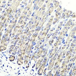 Anti-MAPKBP1 antibody used in IHC (Paraffin sections) (IHC-P). GTX65625