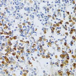 Anti-CHAF1B antibody used in IHC (Paraffin sections) (IHC-P). GTX65808