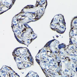 Anti-RanGAP1 antibody used in IHC (Paraffin sections) (IHC-P). GTX65813