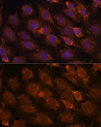 Anti-LZIP antibody used in Immunocytochemistry/ Immunofluorescence (ICC/IF). GTX65817