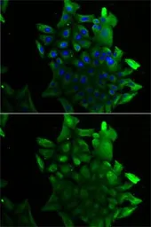 Anti-SLA/LP antibody used in Immunocytochemistry/ Immunofluorescence (ICC/IF). GTX65825