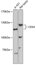 Anti-CD34 antibody used in Western Blot (WB). GTX65833