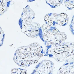 Anti-CD34 antibody used in IHC (Paraffin sections) (IHC-P). GTX65833