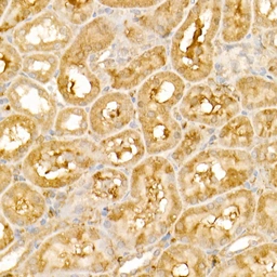 Anti-SSA1 antibody used in IHC (Paraffin sections) (IHC-P). GTX65834