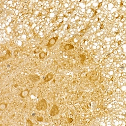 Anti-SSA1 antibody used in IHC (Paraffin sections) (IHC-P). GTX65834