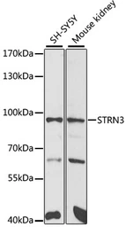 Anti-STRN3 antibody used in Western Blot (WB). GTX65851