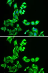 Anti-STRN3 antibody used in Immunocytochemistry/ Immunofluorescence (ICC/IF). GTX65851