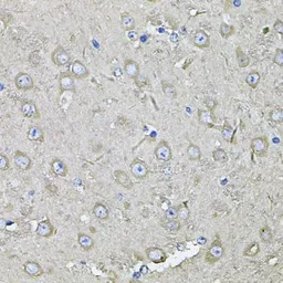 Anti-EIF3S8 antibody used in IHC (Paraffin sections) (IHC-P). GTX65854