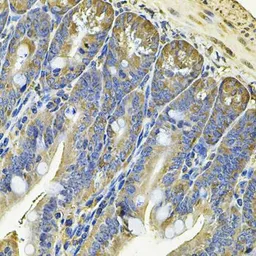 Anti-EIF3S8 antibody used in IHC (Paraffin sections) (IHC-P). GTX65854