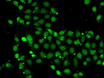 Anti-BAF53B antibody used in Immunocytochemistry/ Immunofluorescence (ICC/IF). GTX65855