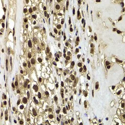 Anti-BAF53B antibody used in IHC (Paraffin sections) (IHC-P). GTX65855