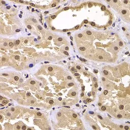 Anti-CSRP2BP antibody used in IHC (Paraffin sections) (IHC-P). GTX65856