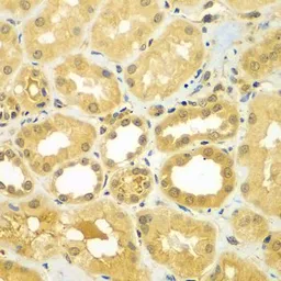 Anti-CoCoA antibody used in IHC (Paraffin sections) (IHC-P). GTX65858