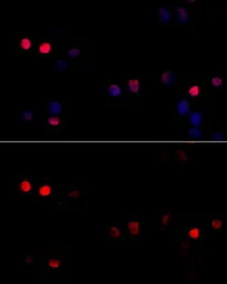 Anti-Cyclin G1 antibody used in Immunocytochemistry/ Immunofluorescence (ICC/IF). GTX65870