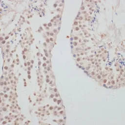 Anti-Cyclin G1 antibody used in IHC (Paraffin sections) (IHC-P). GTX65870
