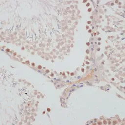 Anti-Cyclin G1 antibody used in IHC (Paraffin sections) (IHC-P). GTX65870