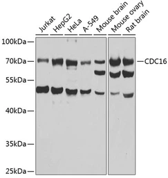 Anti-Apc6 antibody used in Western Blot (WB). GTX65871